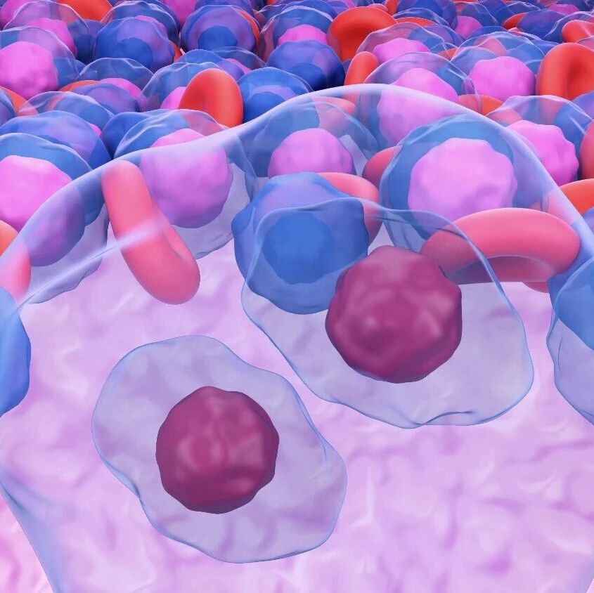 淋巴瘤分类的过去、现在与未来'