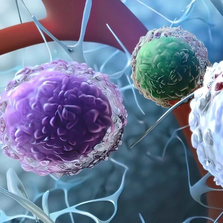 破解CAR-T安全性难题新线索：基于淋巴细胞绝对计数的延迟神经毒性风险分层策略'